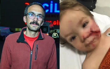 Pitbull saldırısına uğrayan minik Efe'den haber var