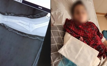 Okulda akran zorbalığı. 9 yaşındaki çocuk arkadaşının kolunu kırdı