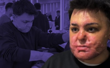 65 ameliyat geçirdi, 12 gün uyutuldu. Felaketi yaşadığı yerde şimdi çalışıyor