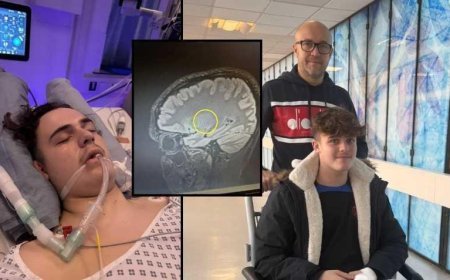 SON DAKİKA HABERLER: Doktorlar 1 yıldır 'basit bir baş ağrısı' diyordu! Acı gerçek sonradan ortaya çıktı: Tedavisi yok