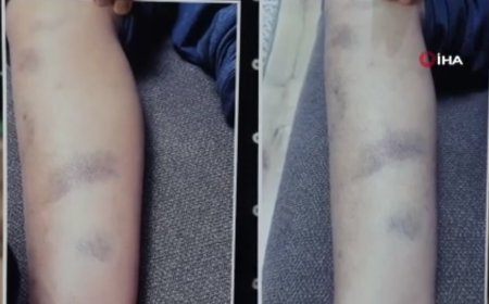 Diyarbakır'da özel okulda öğrenciye dayak iddiasına soruşturma