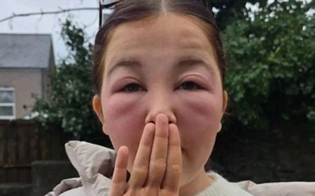 SON DAKİKA HABERLER: Akşam sürüp uyudu, sabah dehşeti yaşadı! Yüz temizleme suyu kabusu oldu