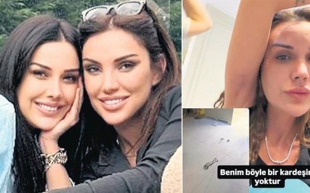 Yolunmuş saçlarını paylaştı