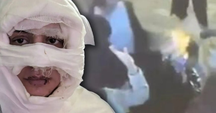 Kadıköy'de genç kadını kolonya döküp yaktı, istenen ceza belli oldu