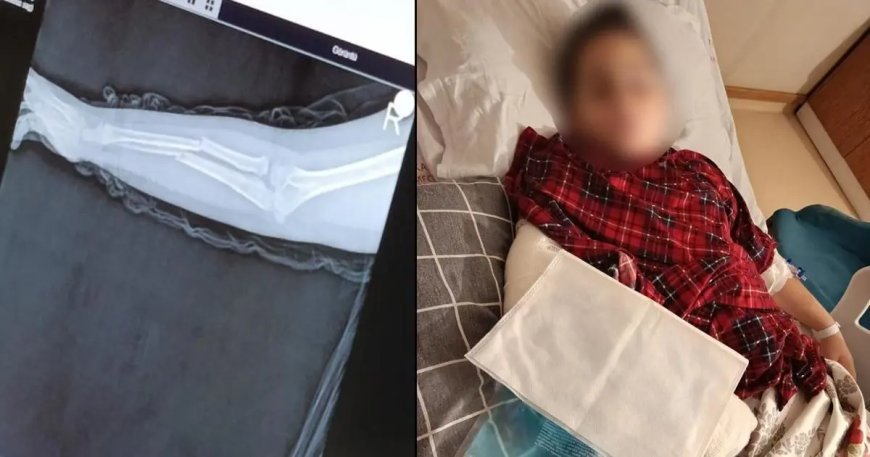 Okulda akran zorbalığı. 9 yaşındaki çocuk arkadaşının kolunu kırdı