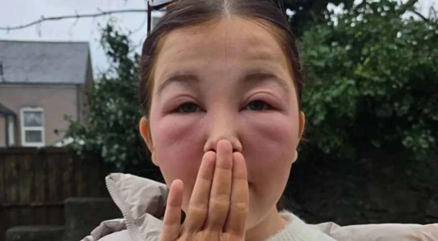 SON DAKİKA HABERLER: Akşam sürüp uyudu, sabah dehşeti yaşadı! Yüz temizleme suyu kabusu oldu