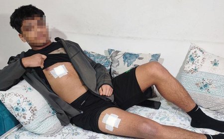 Mesajlaştığı kızın eski sevgilisi ve arkadaşları dehşeti yaşattı! ‘Bıçağı yedi, daha konuşamaz'