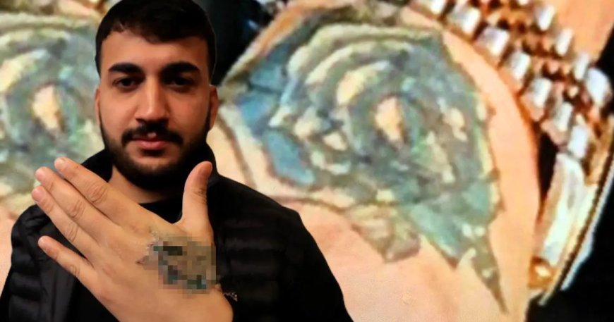 Dövmesini sildirmek istedi, elinden oluyordu