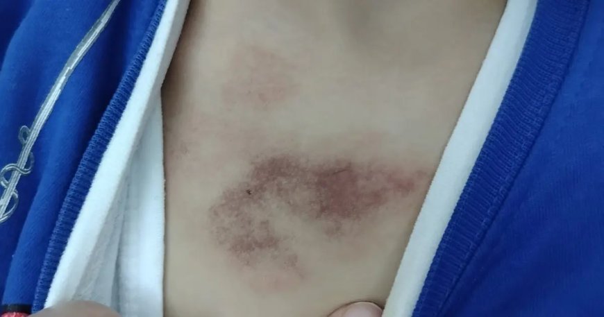 İBB kreşinde çocuğa şiddet ve istismar iddiası. Bakanlık açıklama yaptı