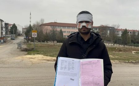 Öğretmen öğretmeni yaktı. Yüzüne sıcak çay fırlattı!