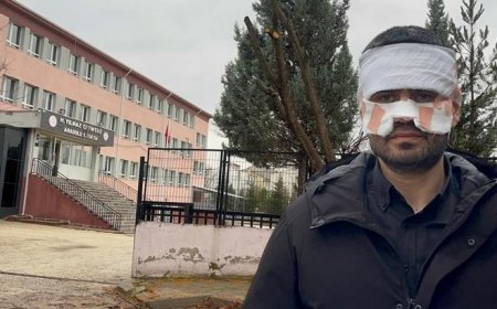 Okulda dehşete düşüren olay! Rehber öğretmen, Fizik öğretmenini kaynar çayla haşladı