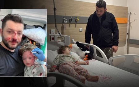 İçişleri Bakanlığı, Yalova’da baba ve 14 aylık bebeğine darp olayıyla ilgili harekete geçti