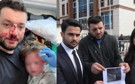 Yalova'da baba ile 14 aylık kızının darbedilmesi. Bebeğe vurduğunu kabul etti!