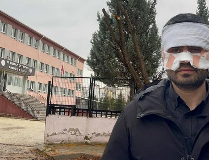 Okulda dehşete düşüren olay! Rehber öğretmen, Fizik öğretmenini kaynar çayla haşladı