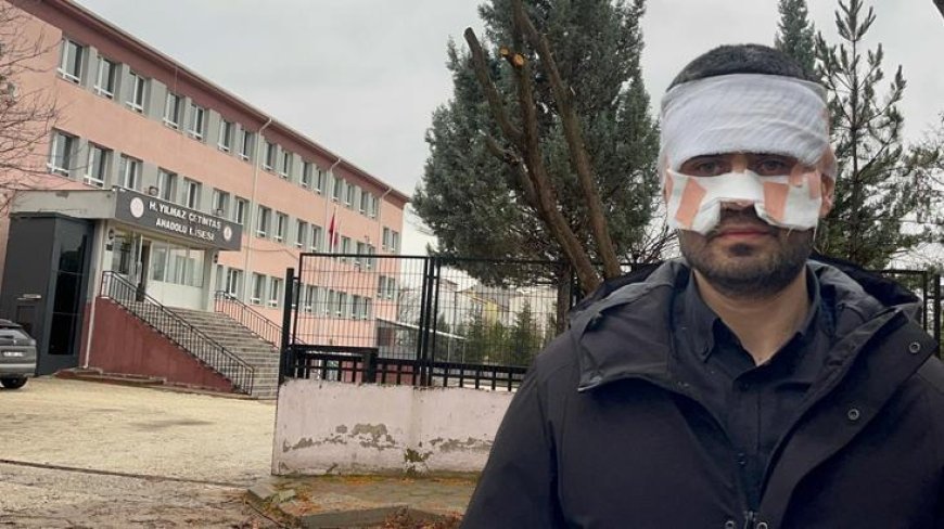 Okulda dehşete düşüren olay! Rehber öğretmen, Fizik öğretmenini kaynar çayla haşladı