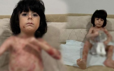 Yaraları tüm vücudunu sardı! 4 yıldır mücadele ediyor: Çaresiz durumda